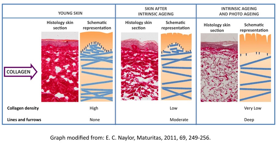 Collagen